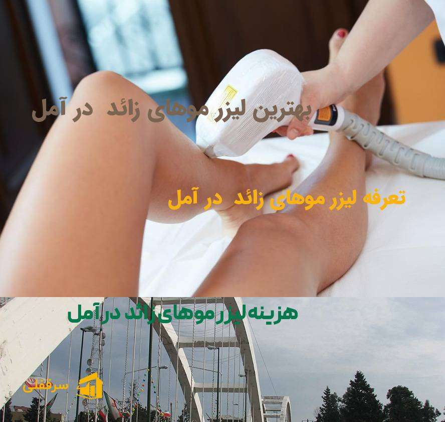 لیزر موهای زائد در آمل