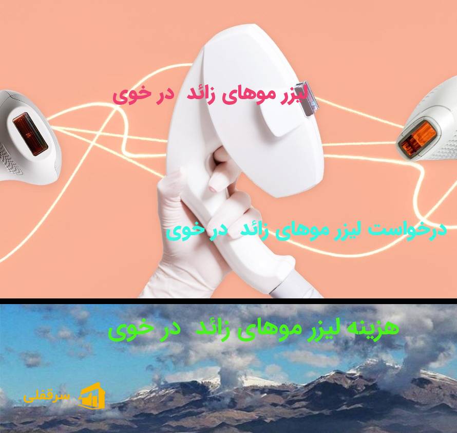 لیزر موهای زائد در خوی