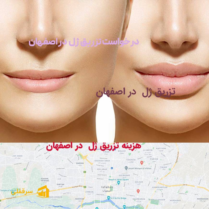 تزریق ژل در اصفهان