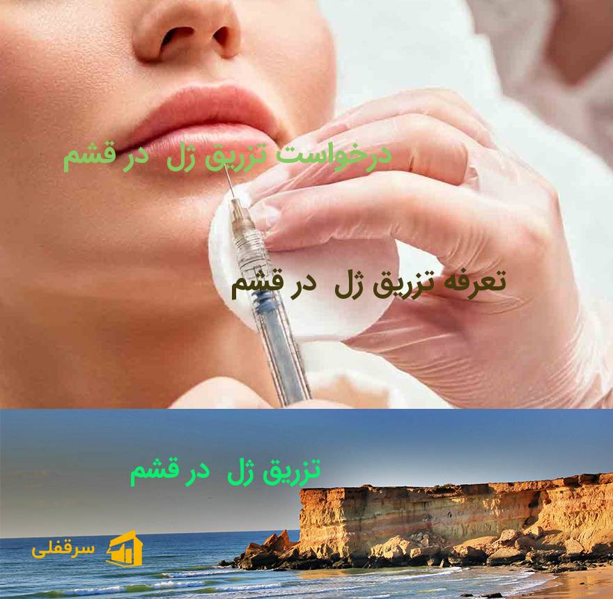 تزریق ژل در قشم