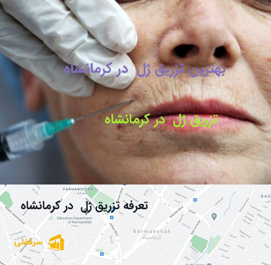 تزریق ژل در کرمانشاه