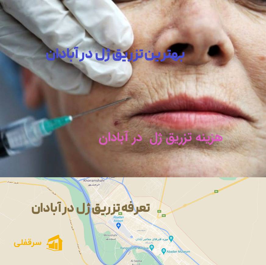 تزریق ژل در آبادان