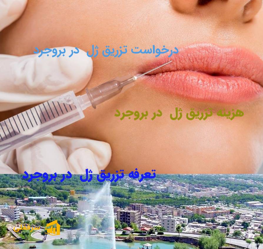 تزریق ژل در بروجرد