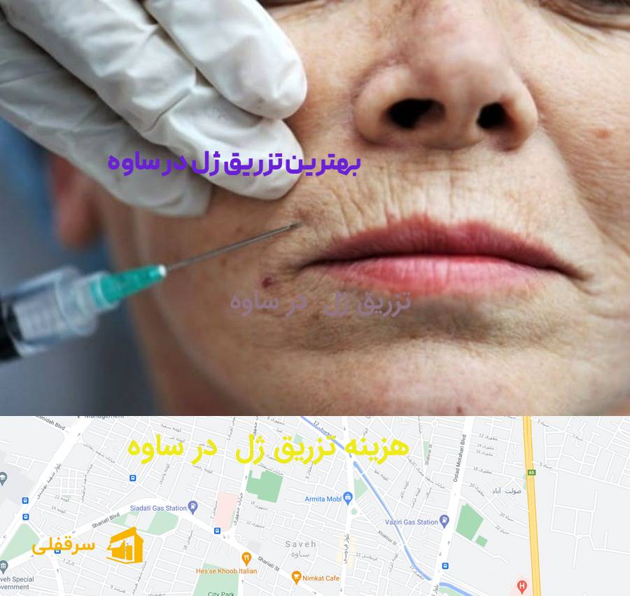 تزریق ژل در ساوه