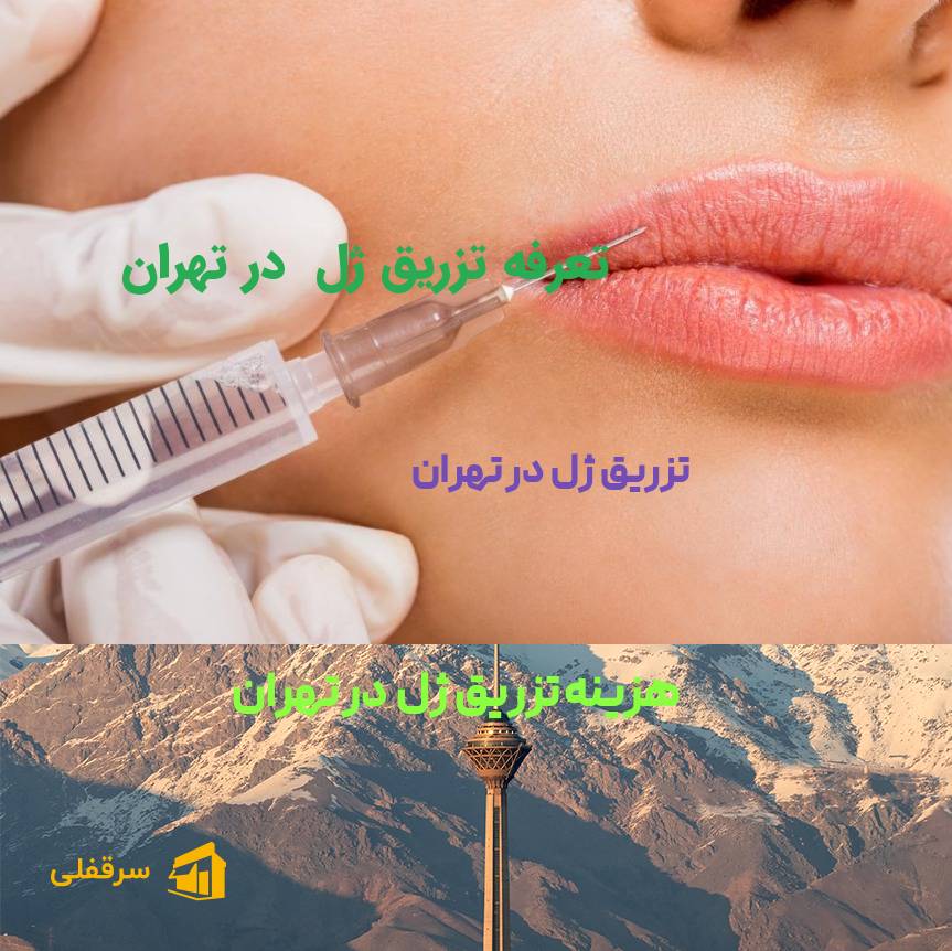 تزریق ژل در تهران