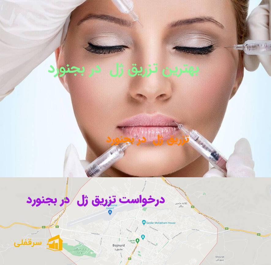 تزریق ژل در بجنورد