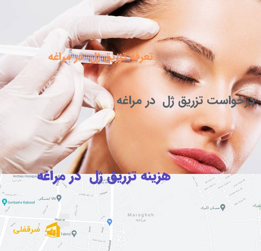 تزریق ژل در مراغه