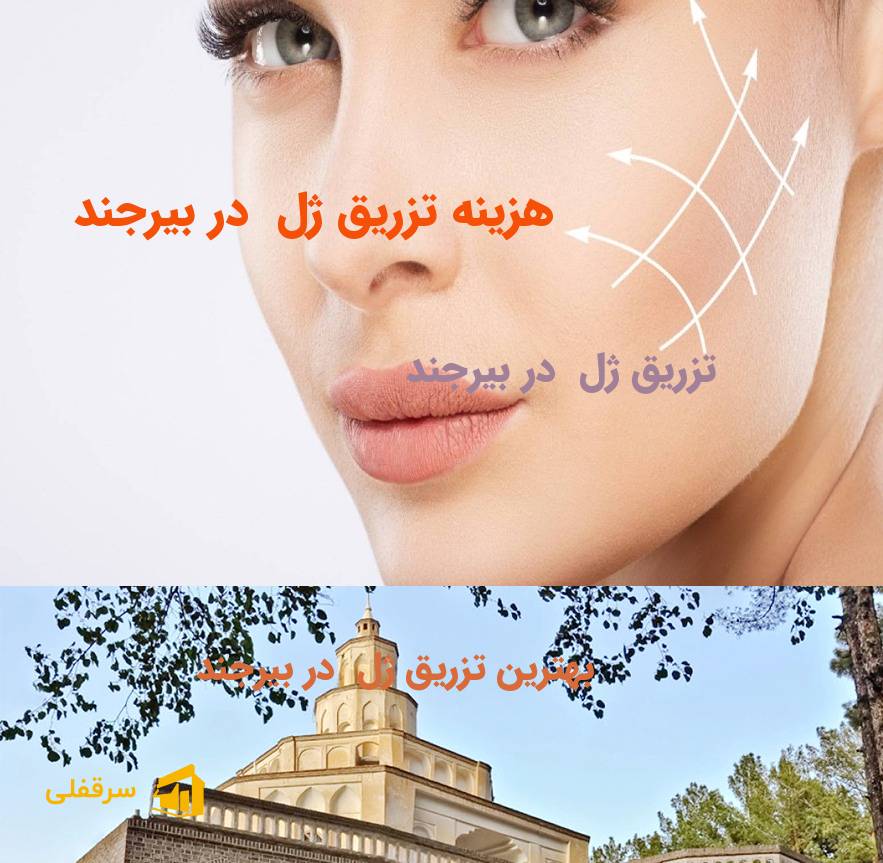 تزریق ژل در بیرجند