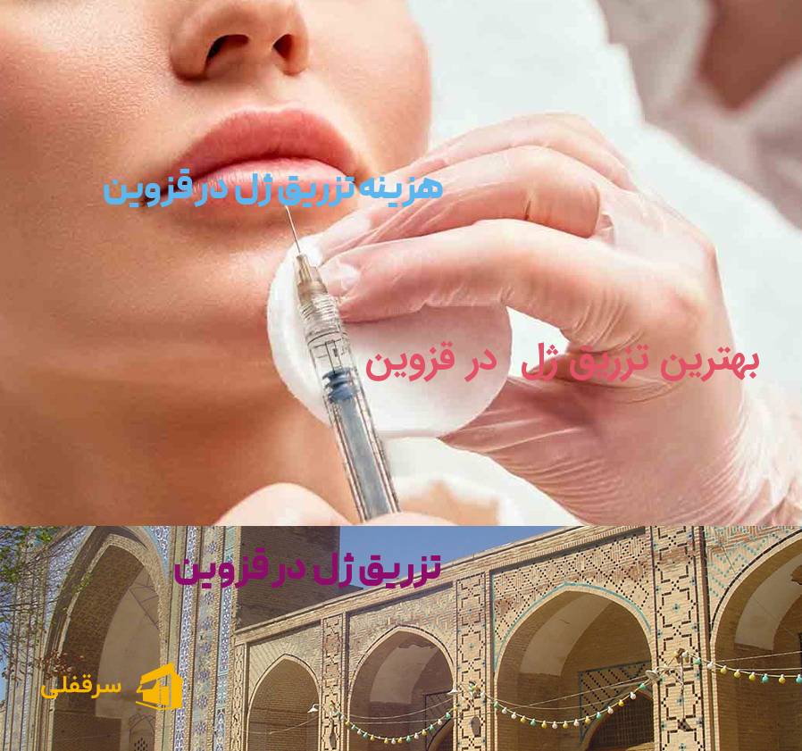 تزریق ژل در قزوین