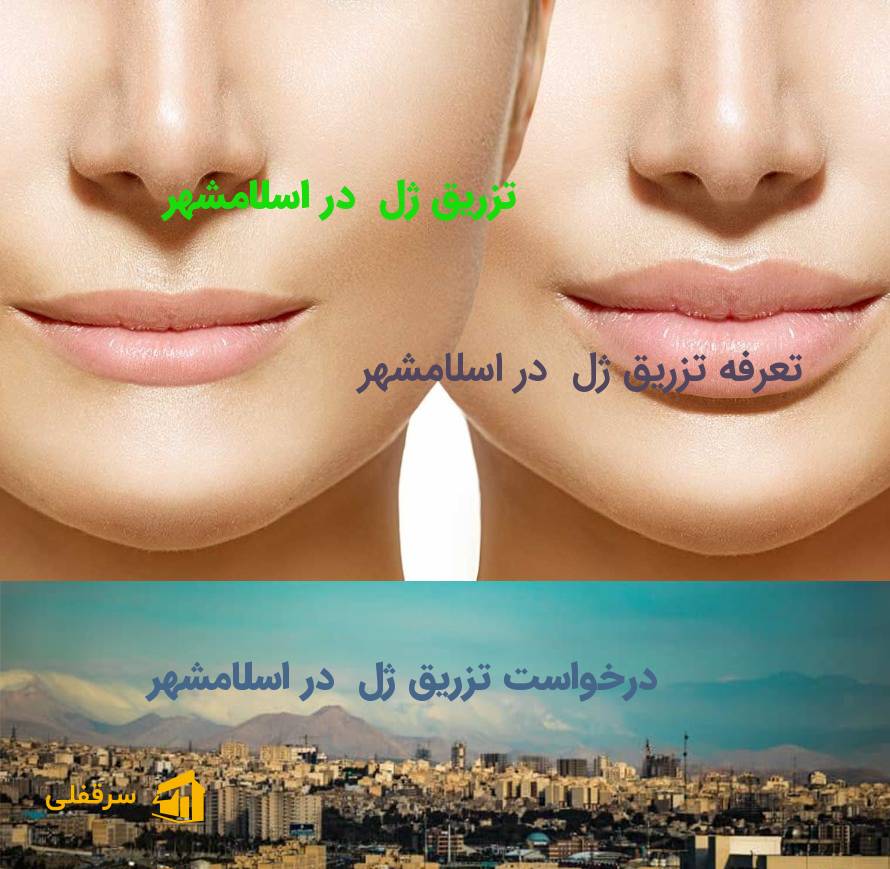 تزریق ژل در اسلامشهر