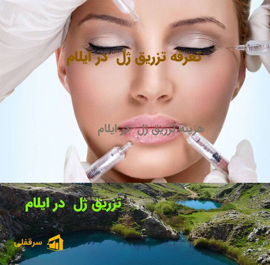 تزریق ژل در ایلام