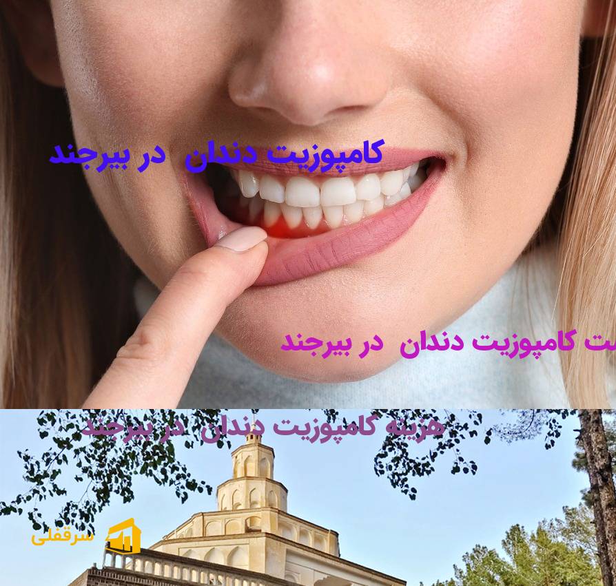 کامپوزیت دندان در بیرجند