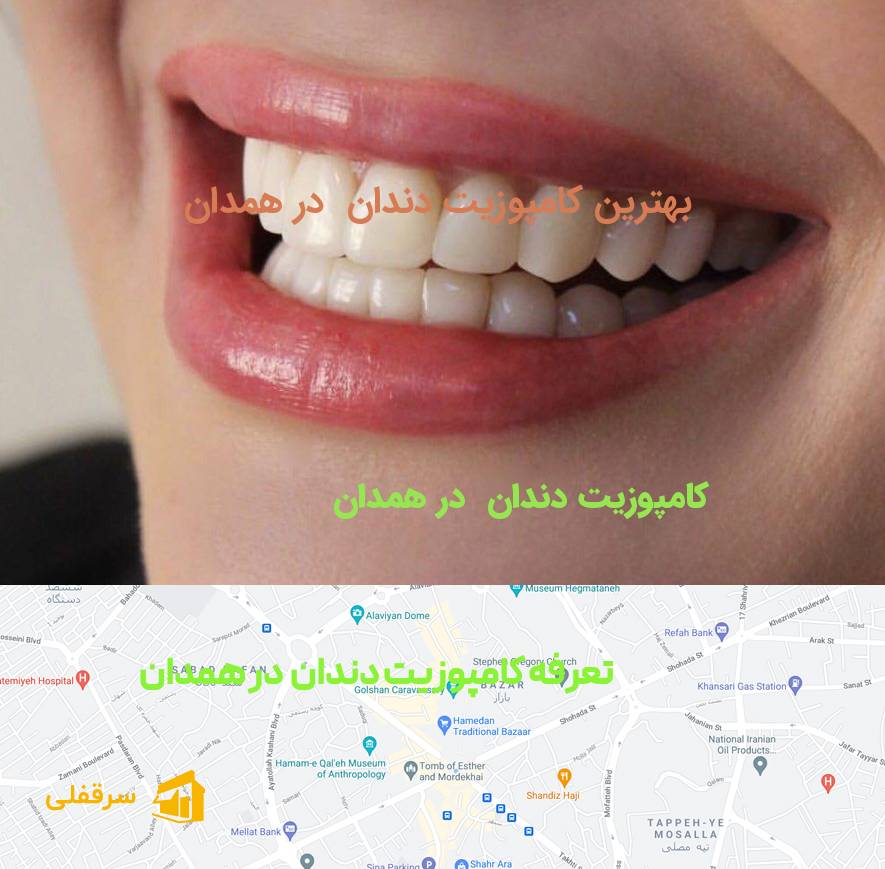 کامپوزیت دندان در همدان