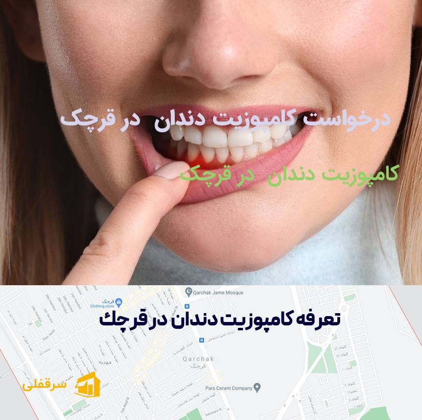 کامپوزیت دندان در قرچک