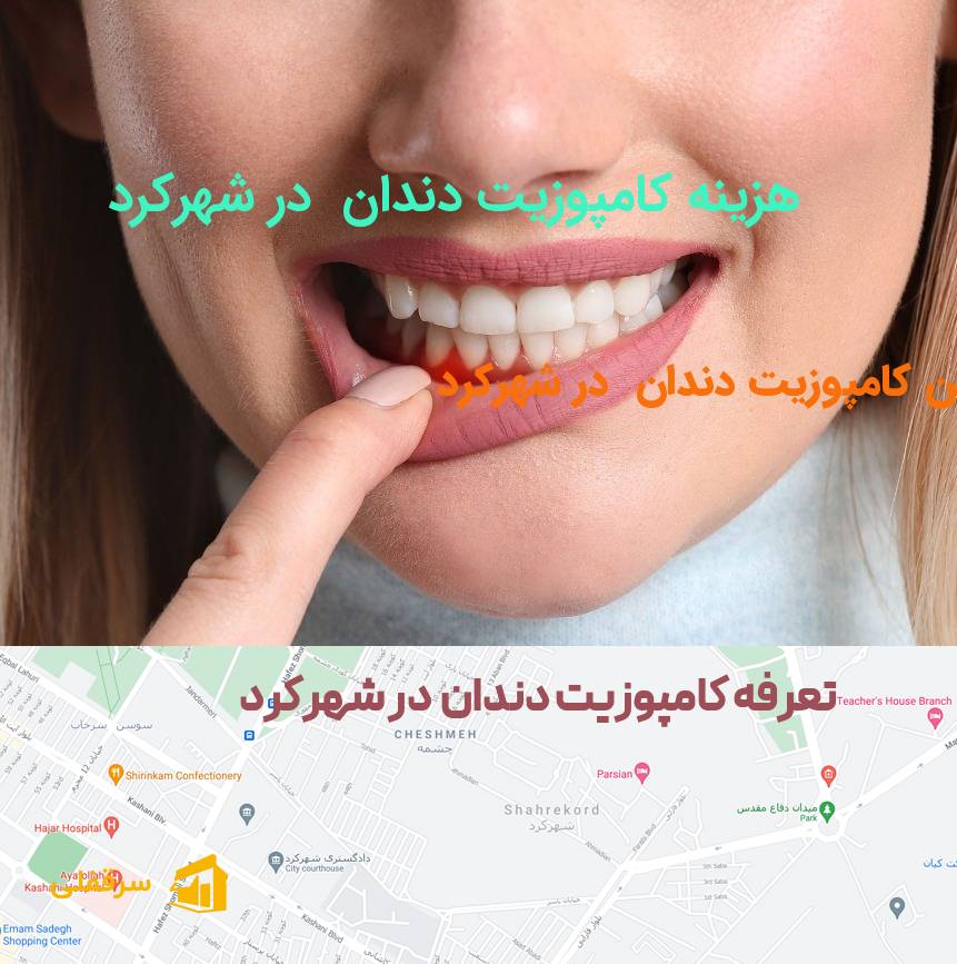 کامپوزیت دندان در شهرکرد