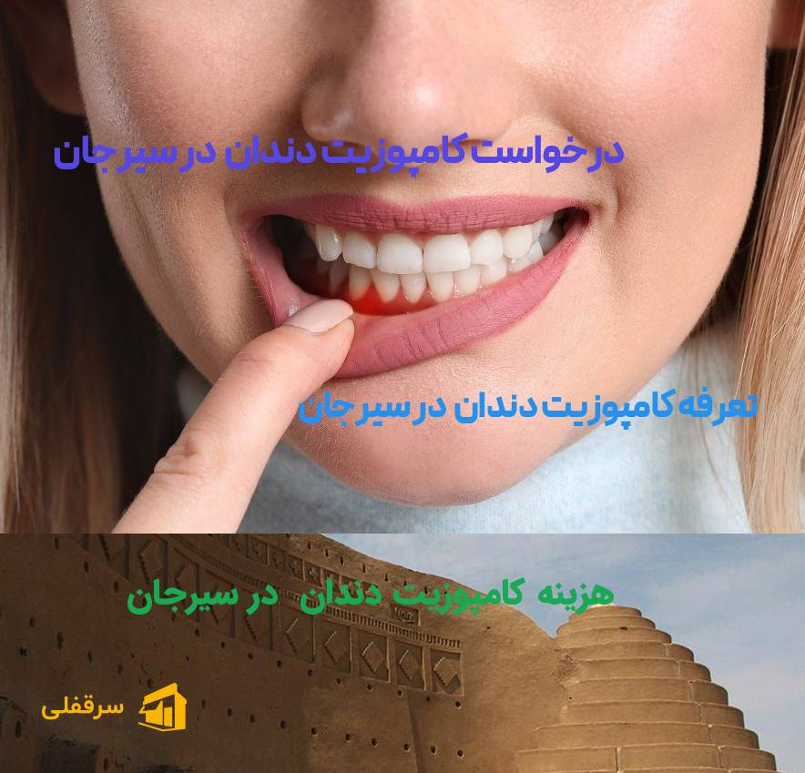 کامپوزیت دندان در سیرجان