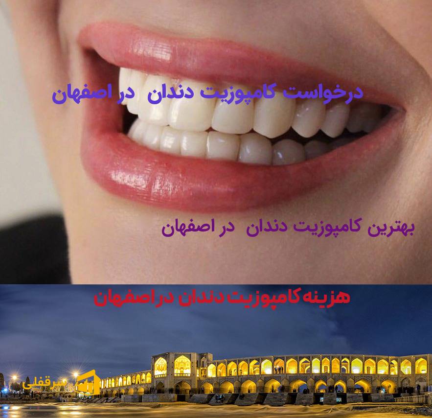 کامپوزیت دندان در اصفهان