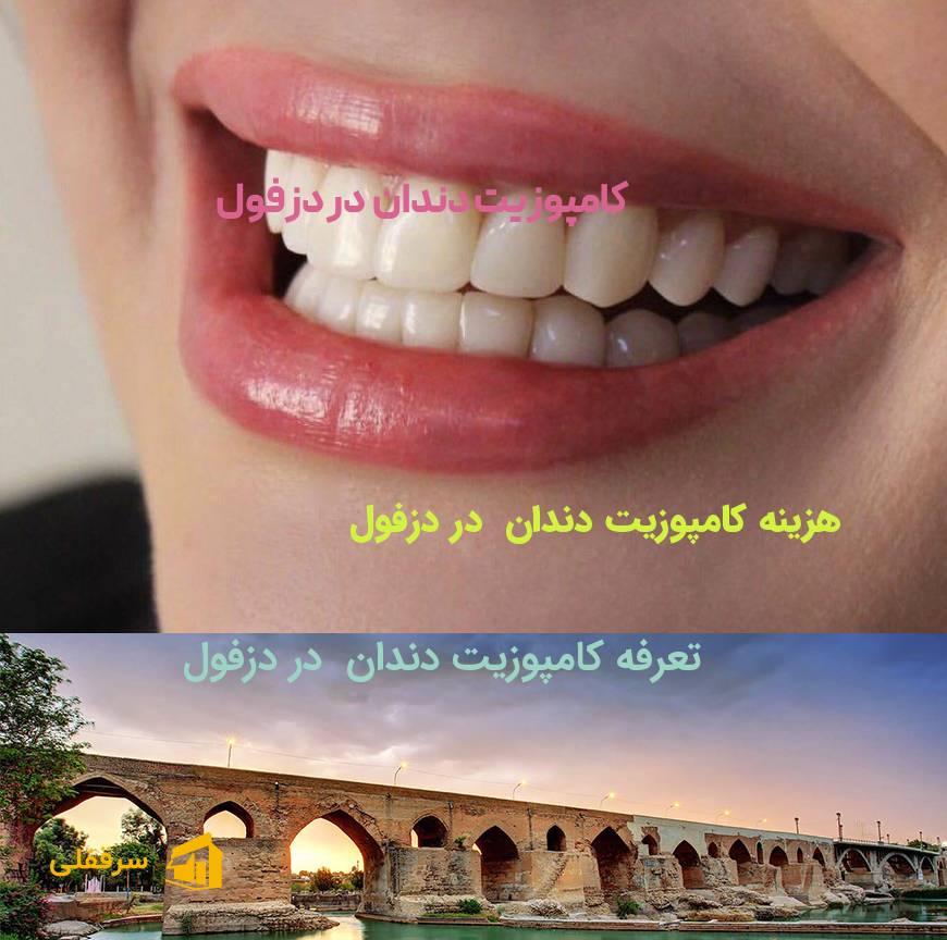 کامپوزیت دندان در دزفول