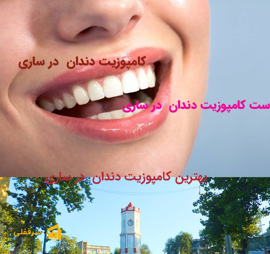 کامپوزیت دندان در ساری