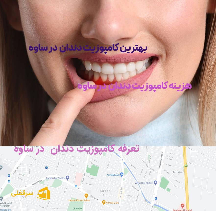 کامپوزیت دندان در ساوه