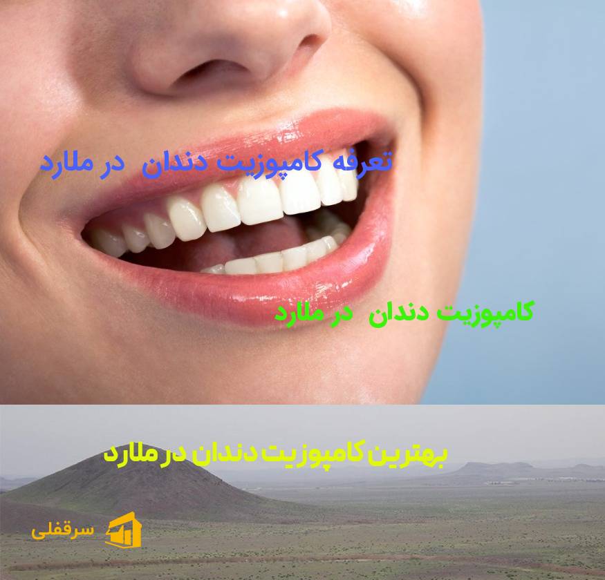 کامپوزیت دندان در ملارد