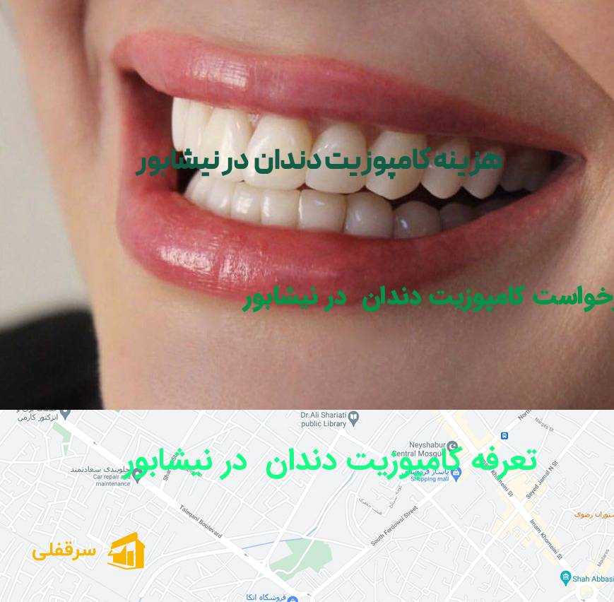 کامپوزیت دندان در نیشابور