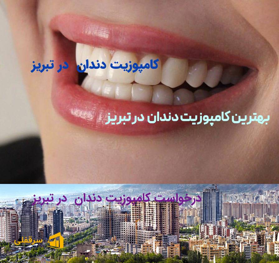 کامپوزیت دندان در تبریز