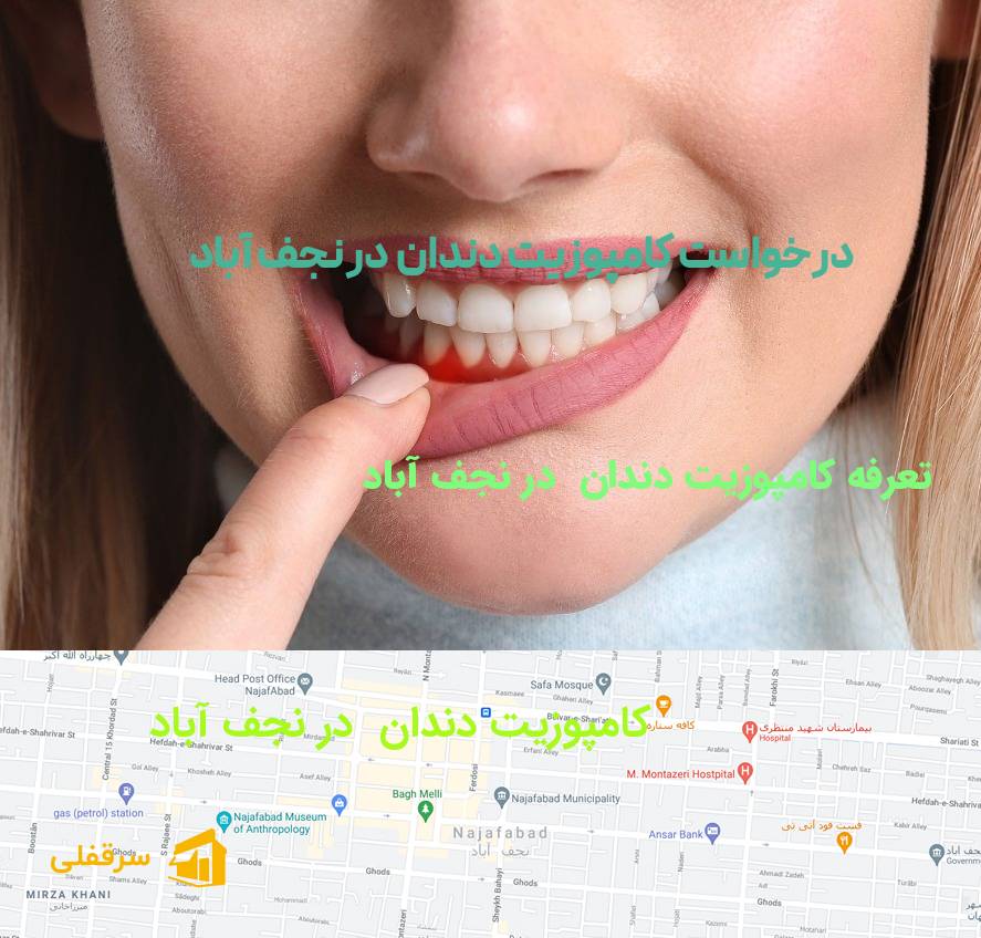 کامپوزیت دندان در نجف آباد