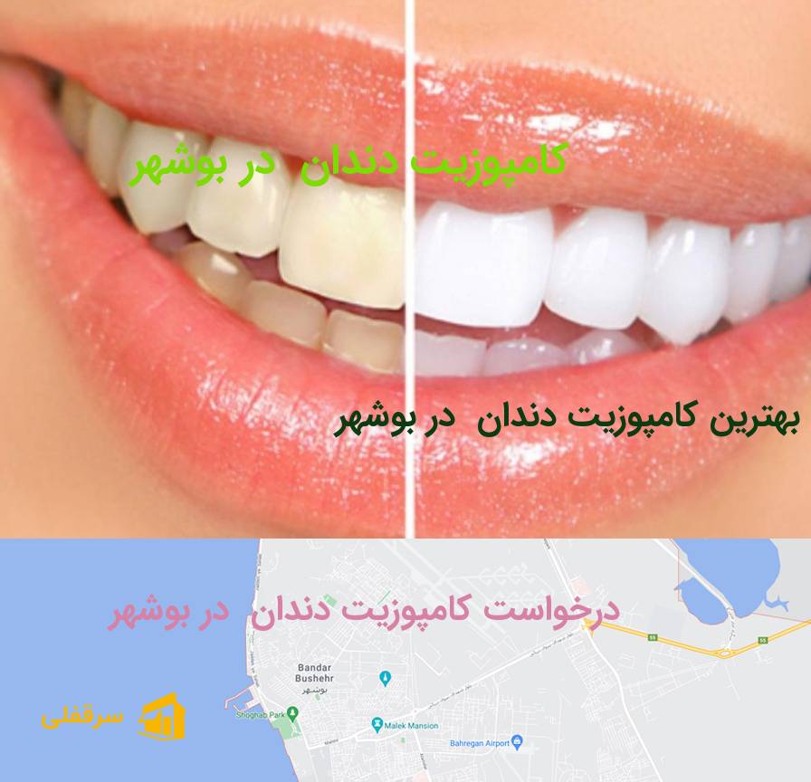 کامپوزیت دندان در بوشهر