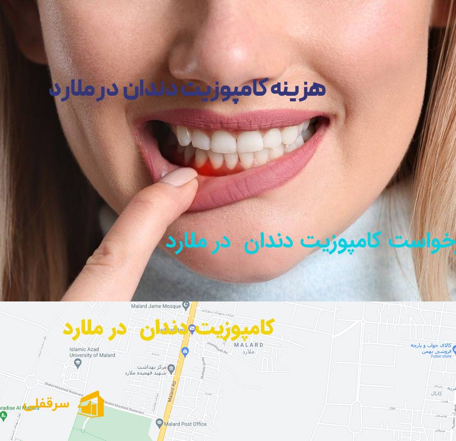 کامپوزیت دندان در ملارد