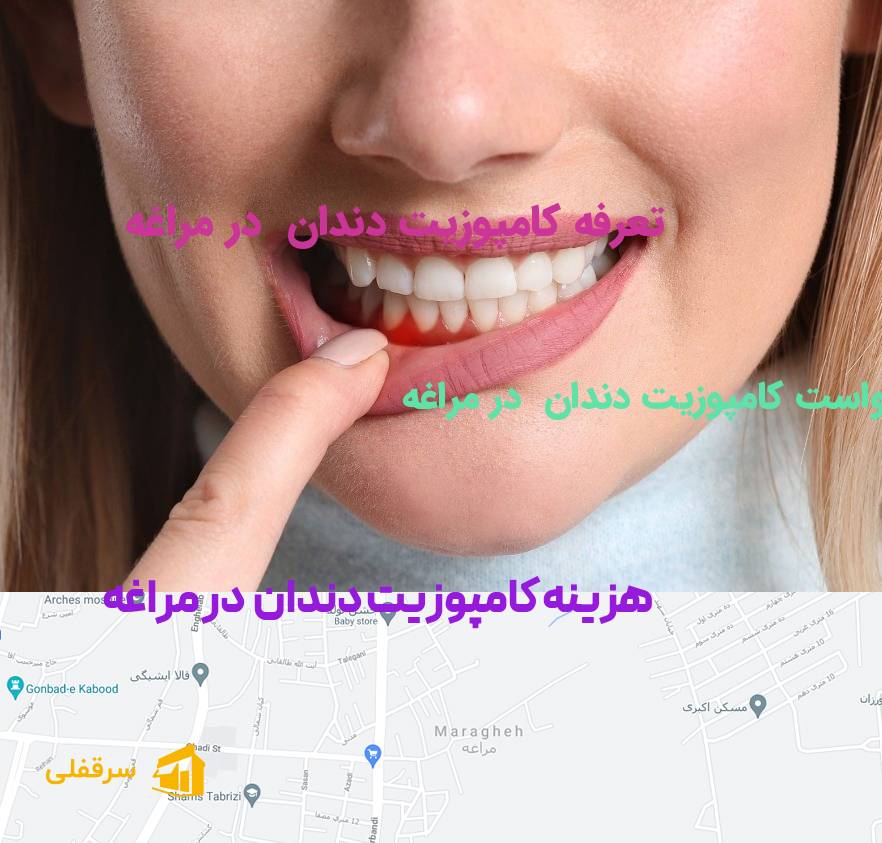 کامپوزیت دندان در مراغه