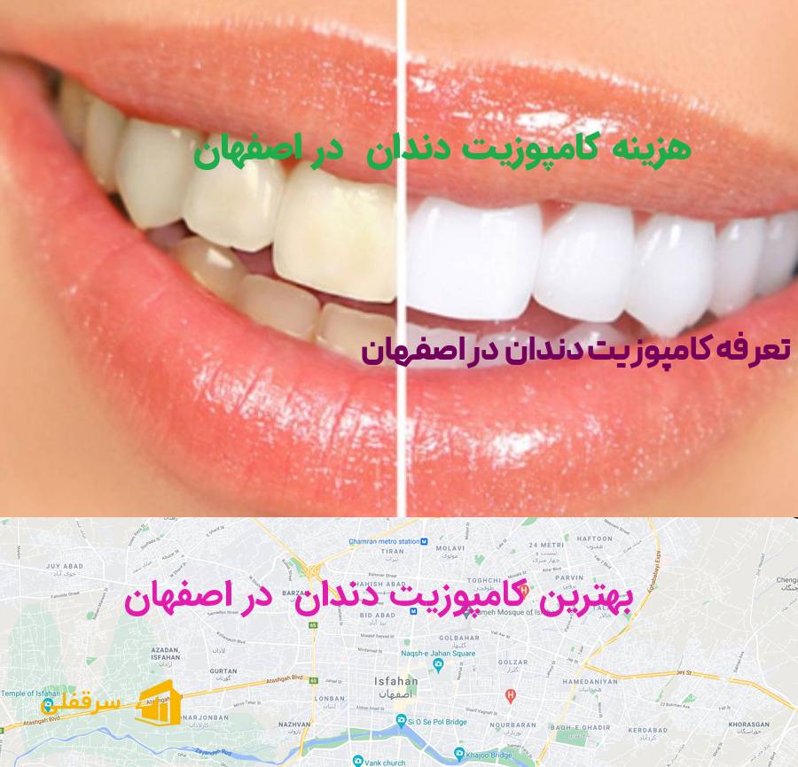 کامپوزیت دندان در اصفهان