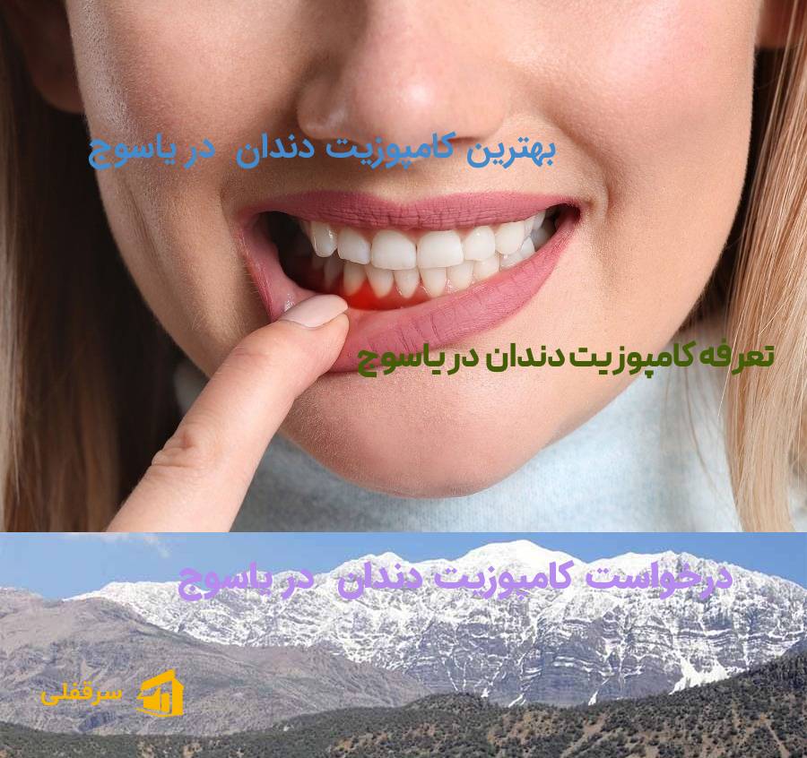 کامپوزیت دندان در یاسوج