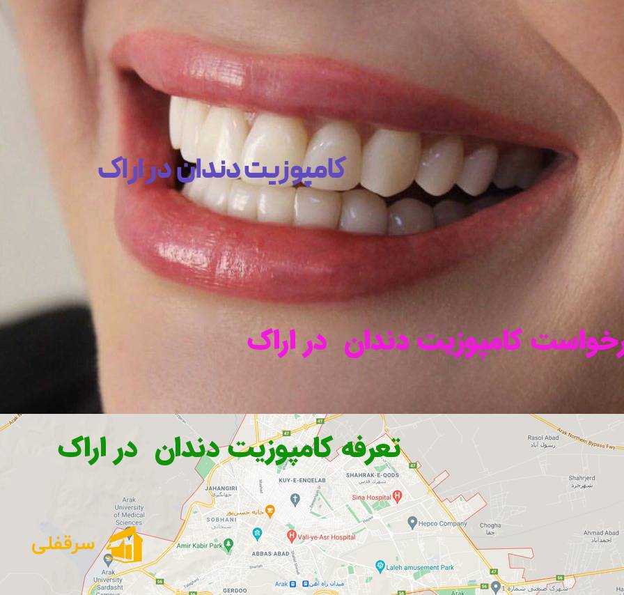 کامپوزیت دندان در اراک