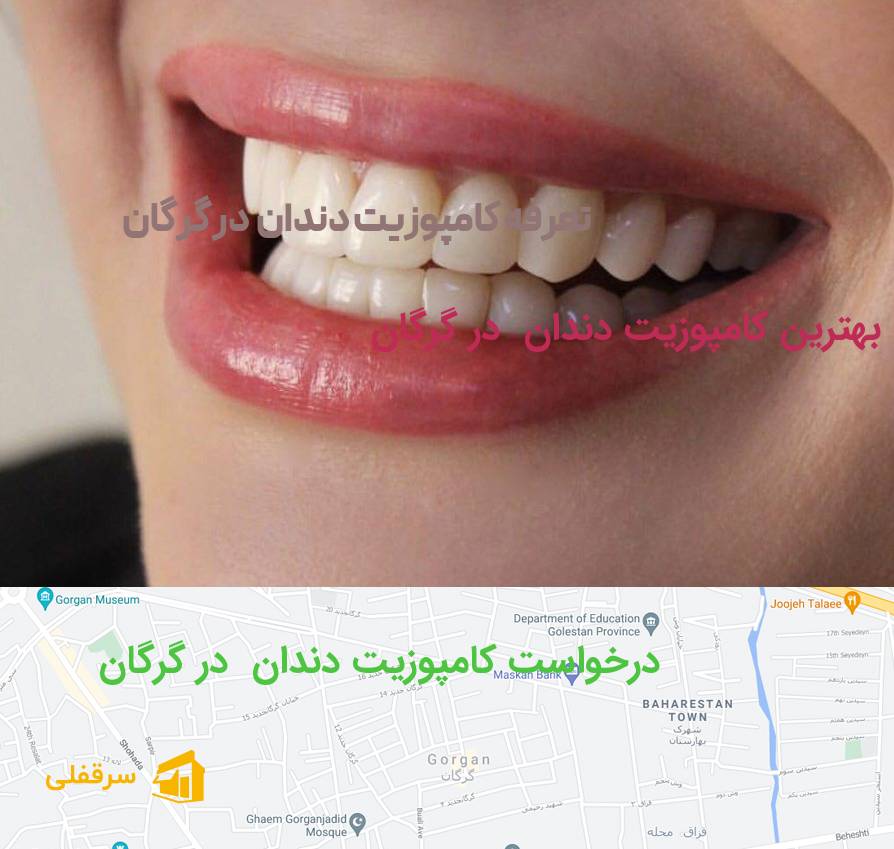 کامپوزیت دندان در گرگان