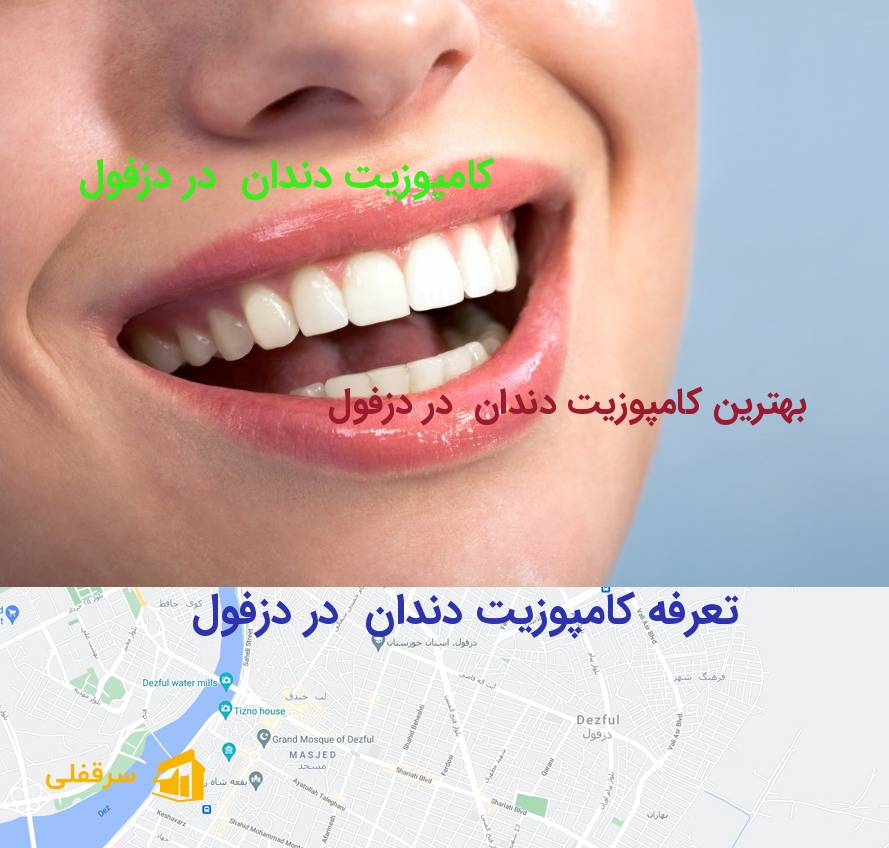 کامپوزیت دندان در دزفول