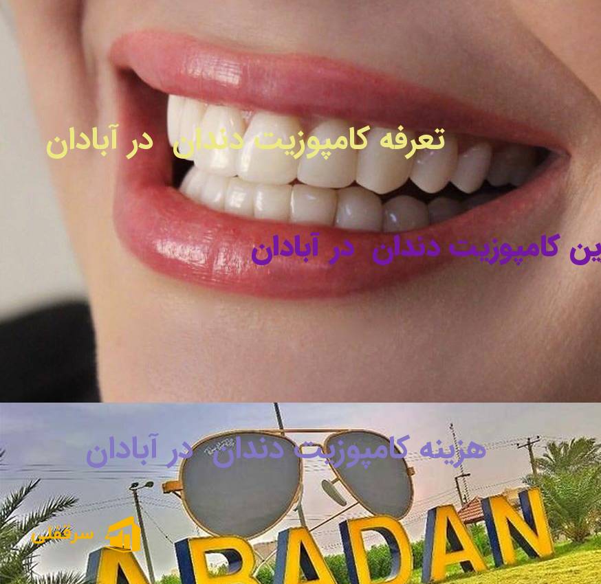 کامپوزیت دندان در آبادان