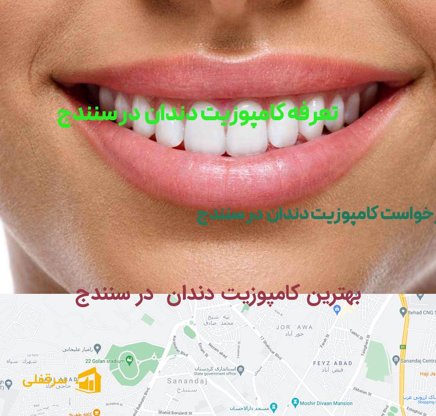 کامپوزیت دندان در سنندج