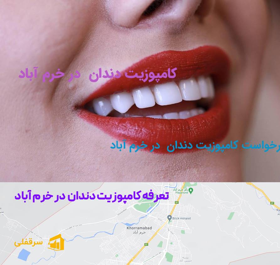 کامپوزیت دندان در خرم آباد