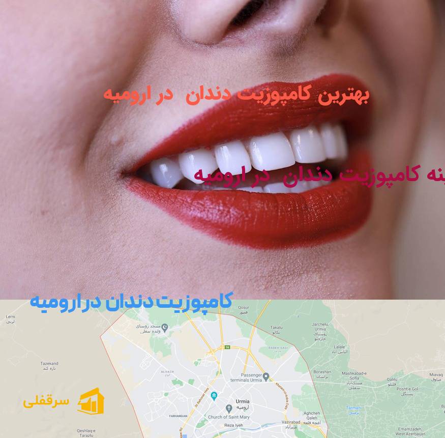 کامپوزیت دندان در ارومیه