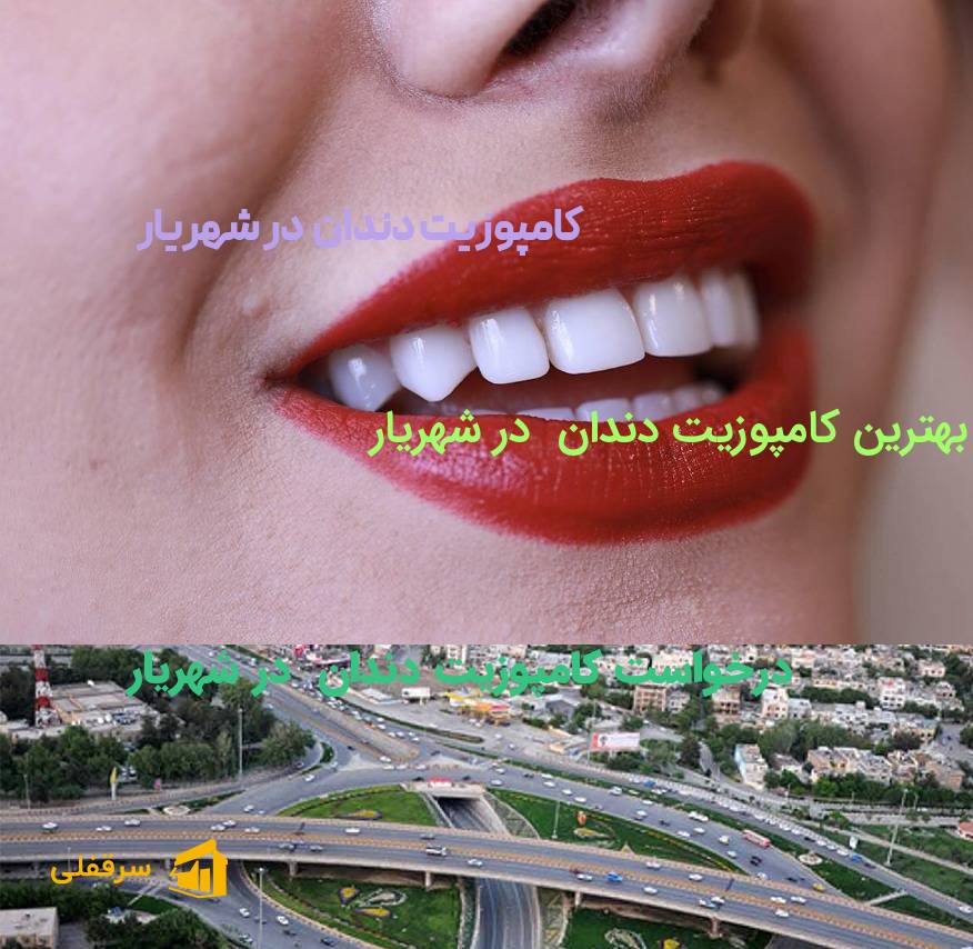 کامپوزیت دندان در شهریار