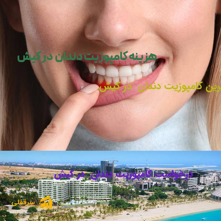 کامپوزیت دندان در کیش