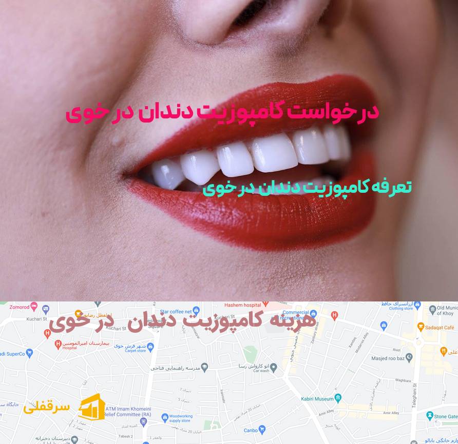 کامپوزیت دندان در خوی