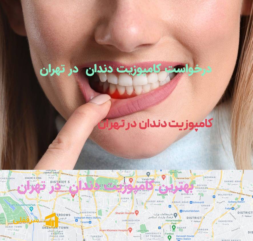 کامپوزیت دندان در تهران